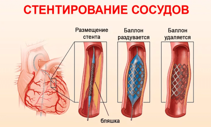 Ключевой фактор – время