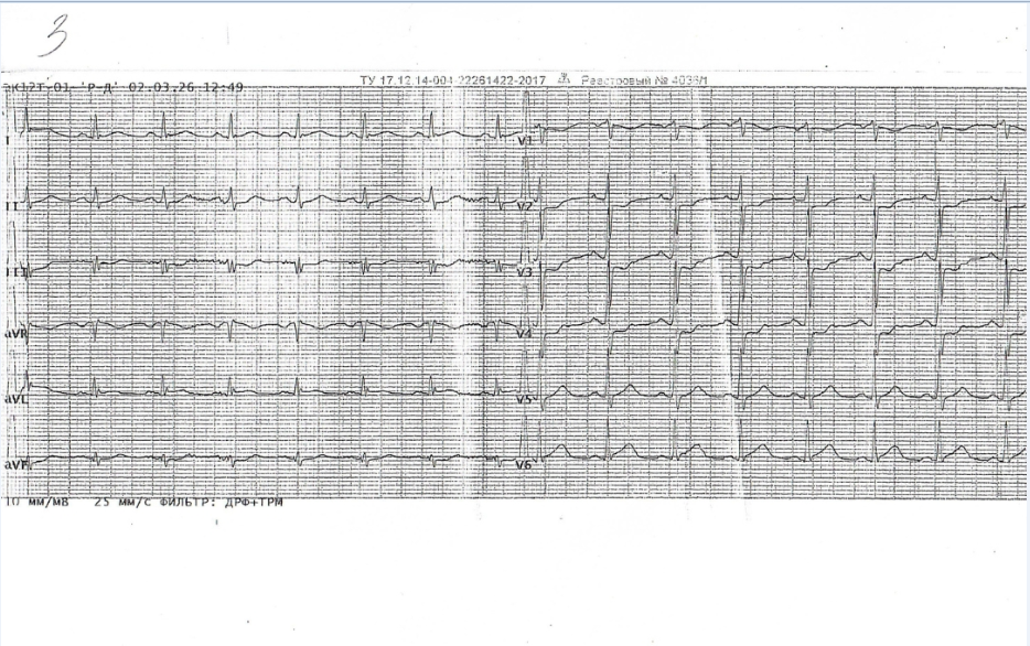Случай из практики: успешная реанимация пациента с остановкой сердца
