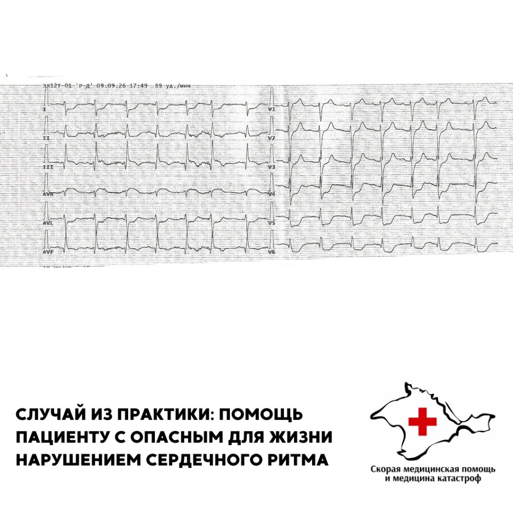 Случай из практики: помощь пациенту с опасным для жизни нарушением сердечного ритма