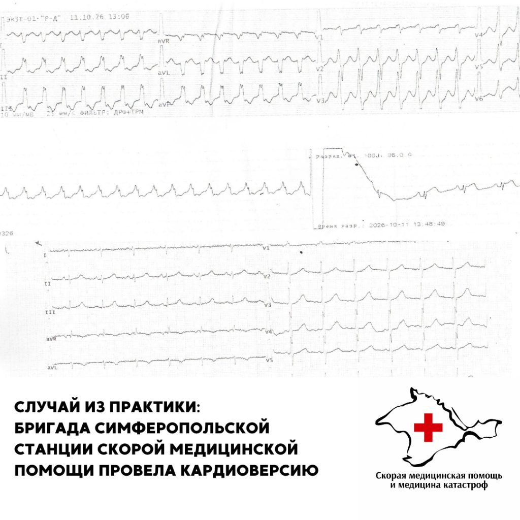 Случай из практики: бригада Симферопольской станции скорой медицинской помощи провела кардиоверсию