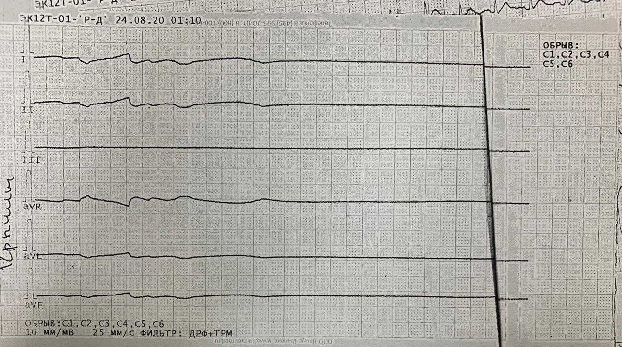 Спасение жизни 44летнего жителя г.Ялта